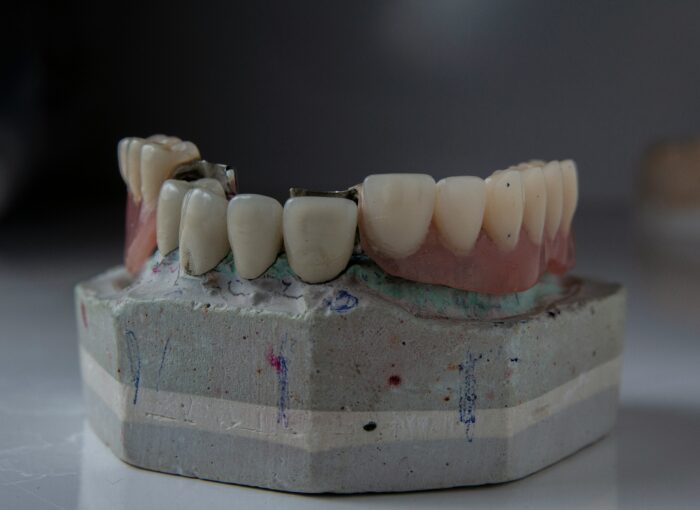 Диагностика стоматологической установки