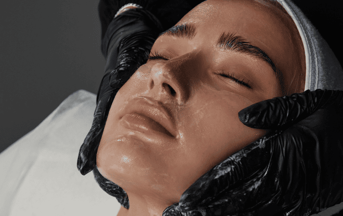 Процедура RF-лифтинга: эффективное омоложение кожи без операции