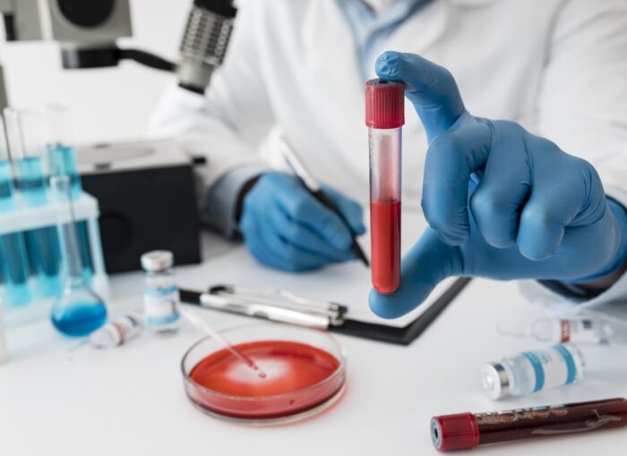 Когда необходимо пройти полный анализ мочи повторно