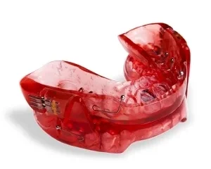 Капа от храпа: как работает, кому подходит и какую выбрать